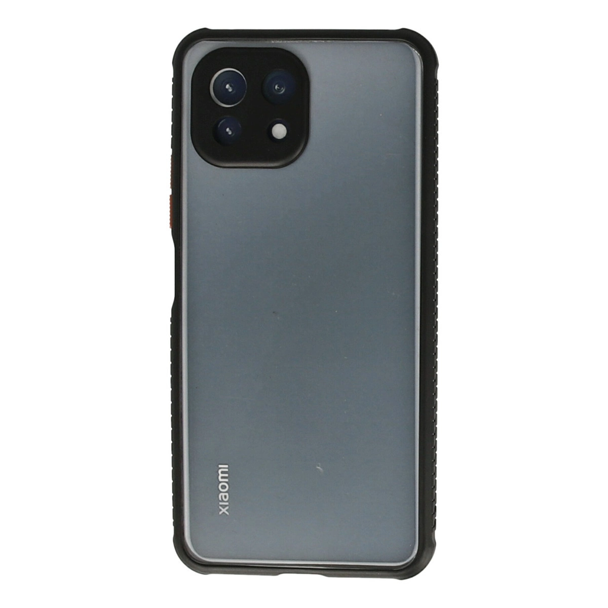 Xiaomi Mi 11 Lite Kılıf Miami Şeffaf Silikon - Siyah
