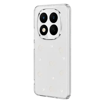Xiaomi Redmi Note 15 4g Fiyonk Desenli Kapak - Desen 10