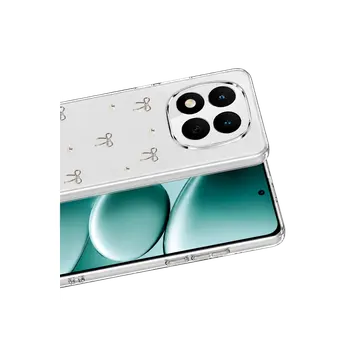 Xiaomi Redmi Note 15 Pro Plus 5g Fiyonk Desenli Kapak - Desen 5