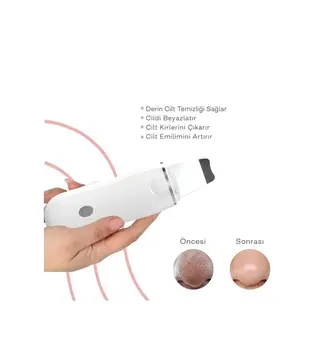 Ultrasonik Spatula Yüz Akne Giderici Siyah Nokta Temizleme Cihazı