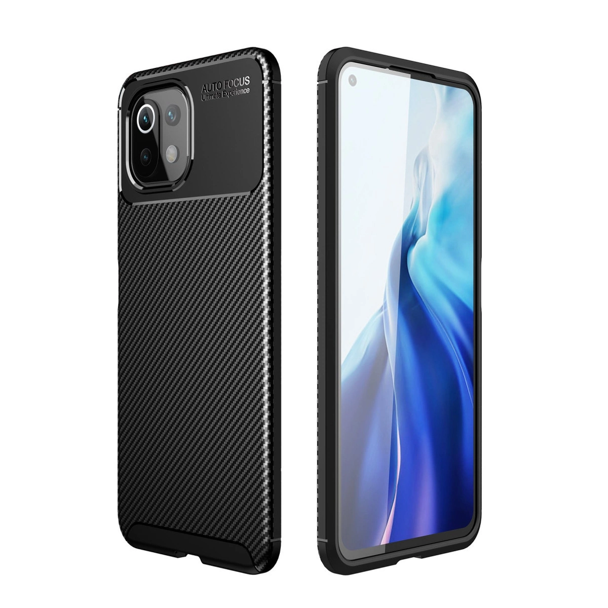 Xiaomi Mi 11 Lite Kılıf Auto Focus Karbon Kapak - Siyah